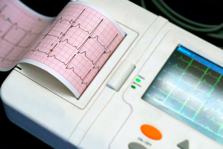 Sistemi ECG Holter 